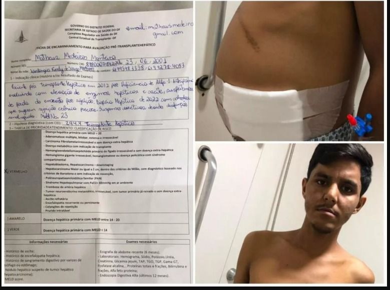 Jovem de Patos luta por novo transplante de fígado e pede ajuda para tratamento