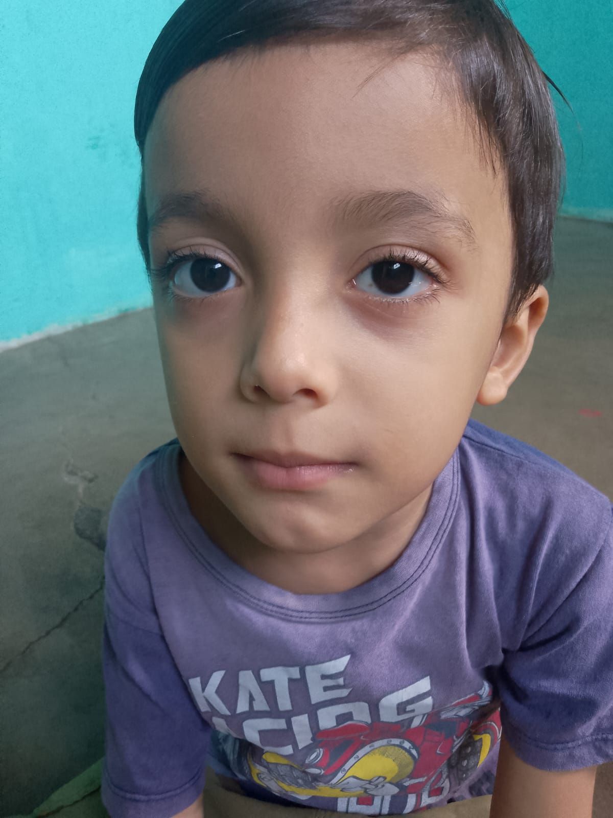 Mãe do município de Santa Terezinha realiza campanha para cirurgia de seu filho de apenas 4 anos; veja